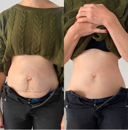 Testemunho Visual - Antes e Depois