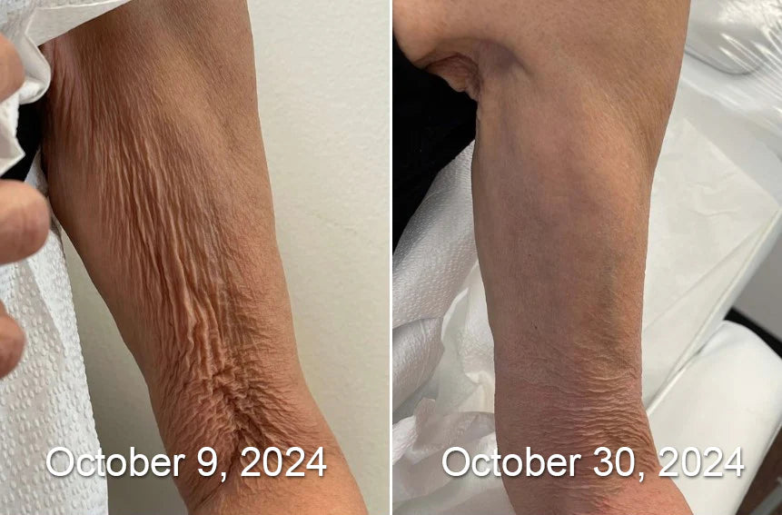 Como Usar BEENOM - Guia Visual