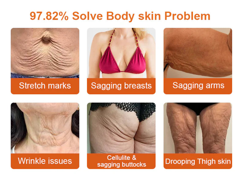 Antes e Depois - Pescoço