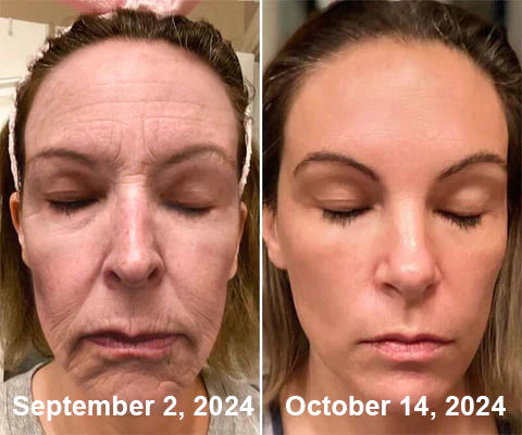 Cliente Satisfeita - Antes e Depois