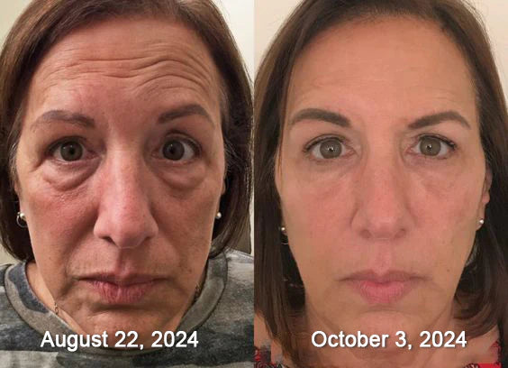 Ingredientes Ativos BEENOM